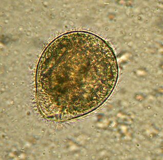 Balantidium is the largest protozoa parasite