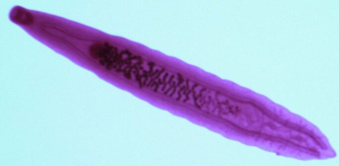 parasites fluke from the human body