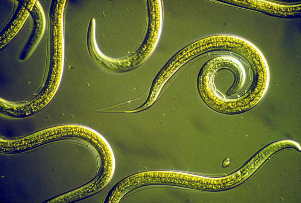 hookworm infection,