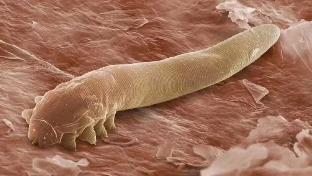 The parasites in the human body